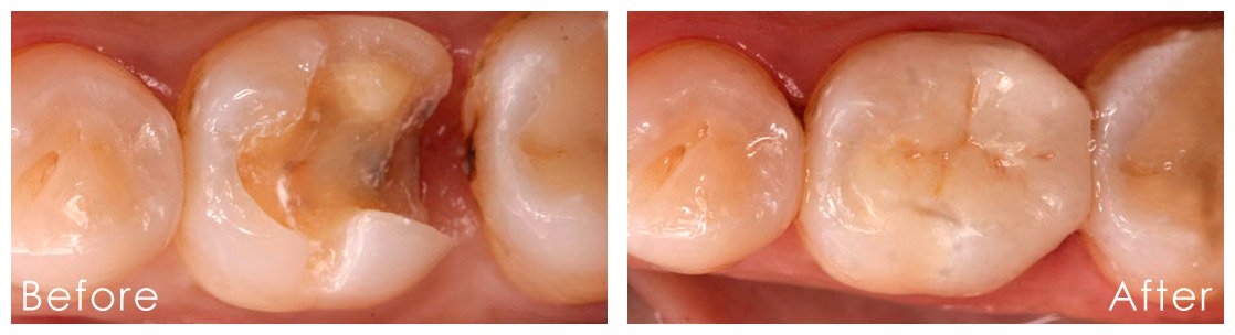 Treatment overview