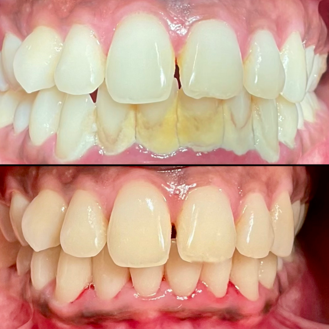 Treatment overview