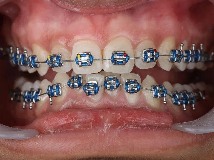 Treatment overview
