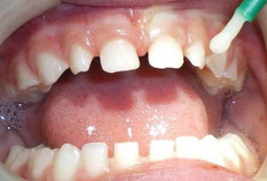 Treatment overview