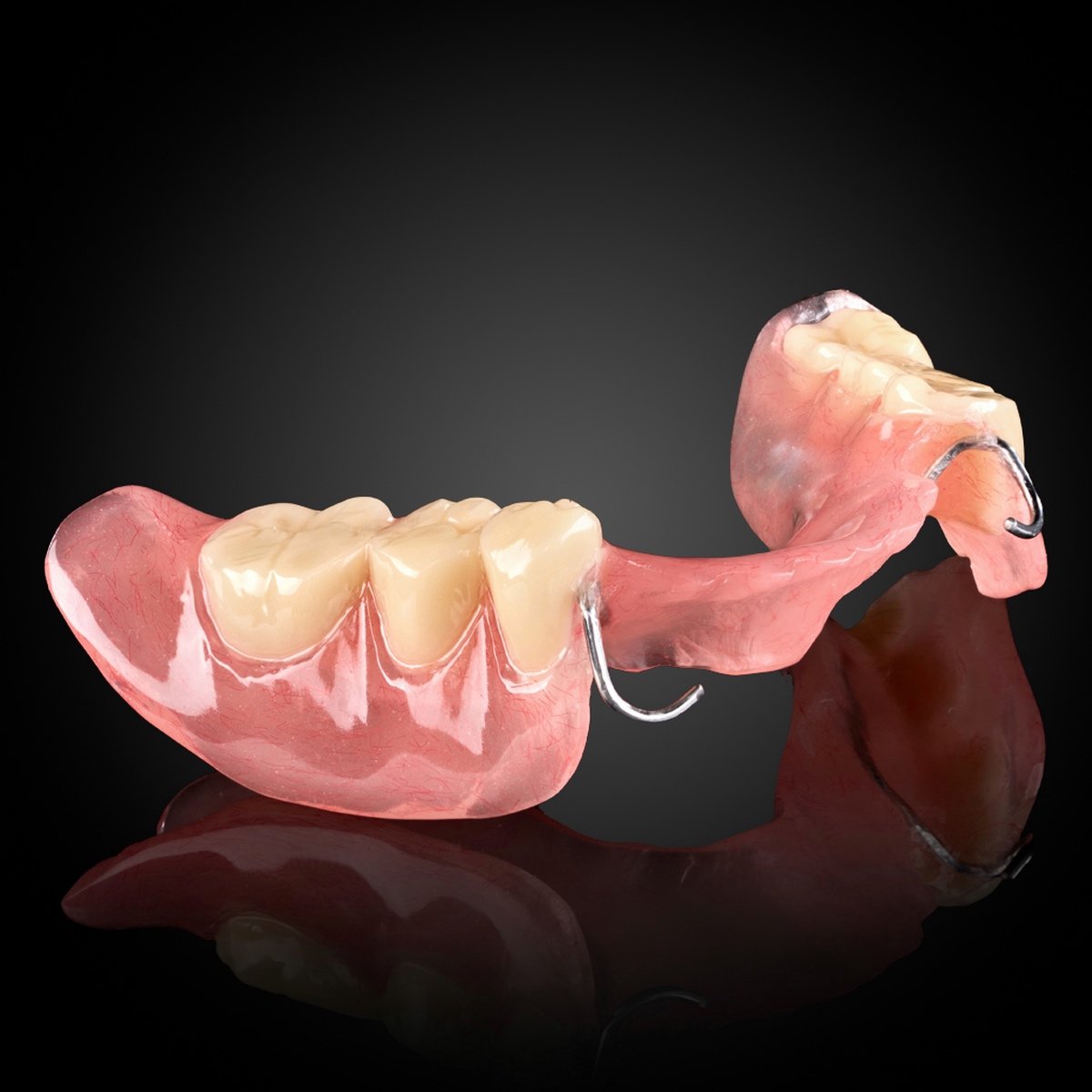 Removable partial denture — restoring missing teeth while keeping remaining natural teeth intact