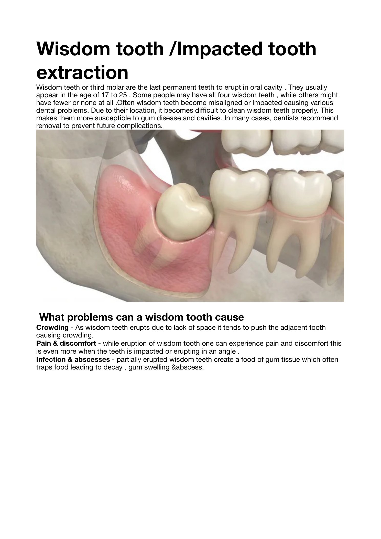 Wisdom tooth / impacted tooth extraction — clinical overview & common problems