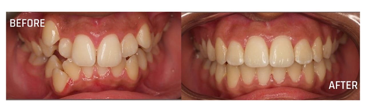 Teeth Whitening & Cosmetic Dentistry